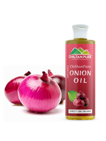Onion Hair Oil - Anti Hair Fall/Accelerates Hair Regrowth